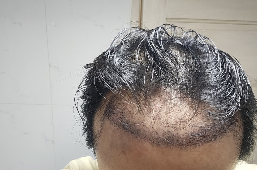 정면