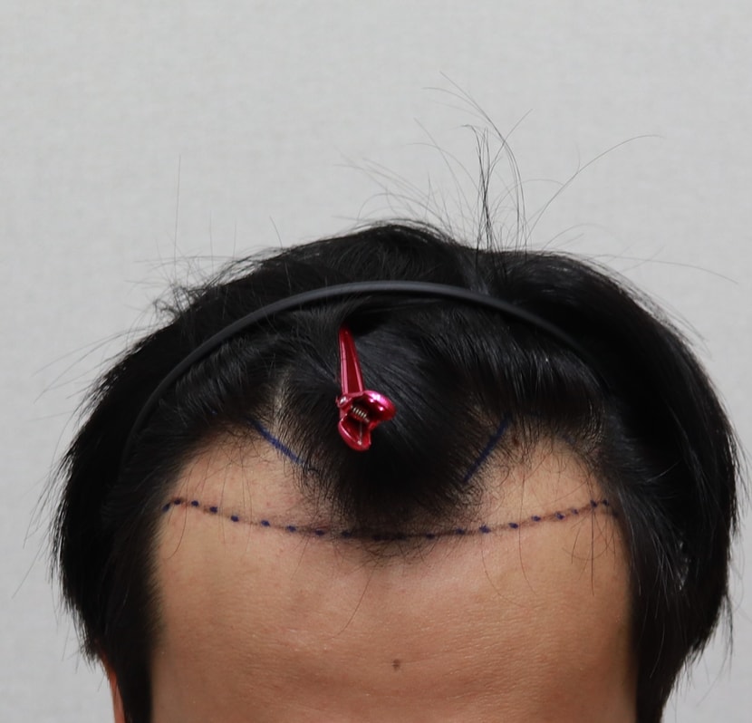 디자인후