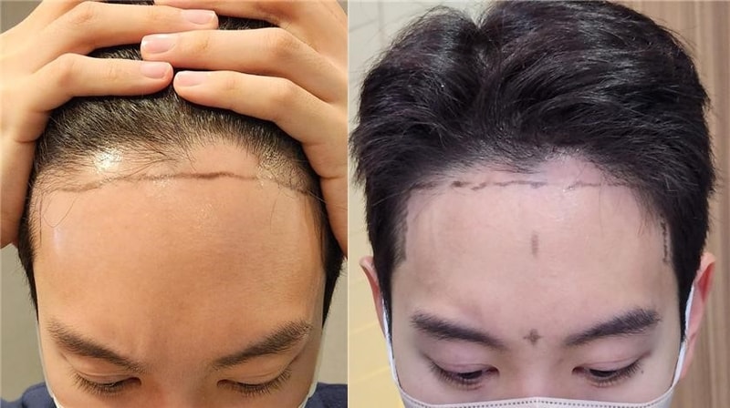 病院ごとに母数の差が大きい場合ですが、ご意見をお願いします