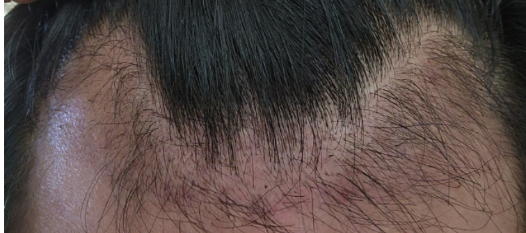 60일차