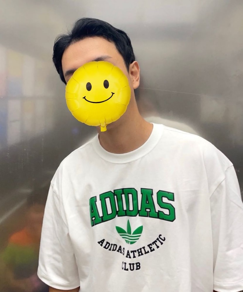 수술후 처음 머리 올린날