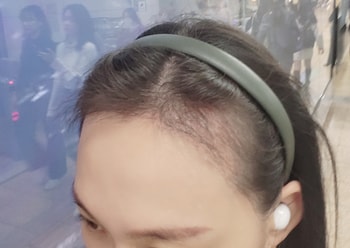 M자 라인이 허허벌판 ㅎㅎ