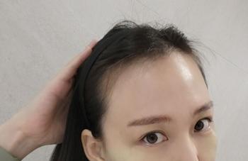 수술전