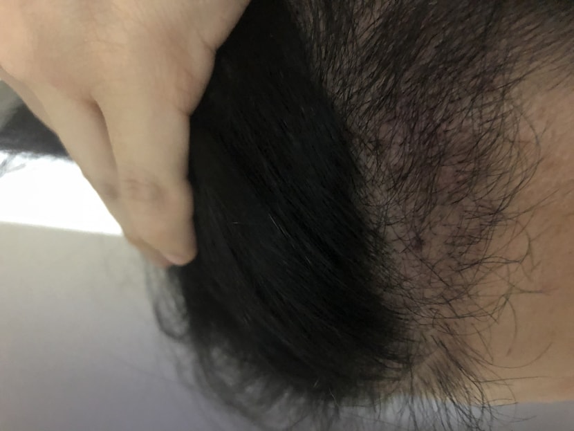 오