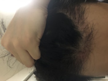 정면
