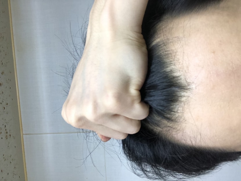 이식 전