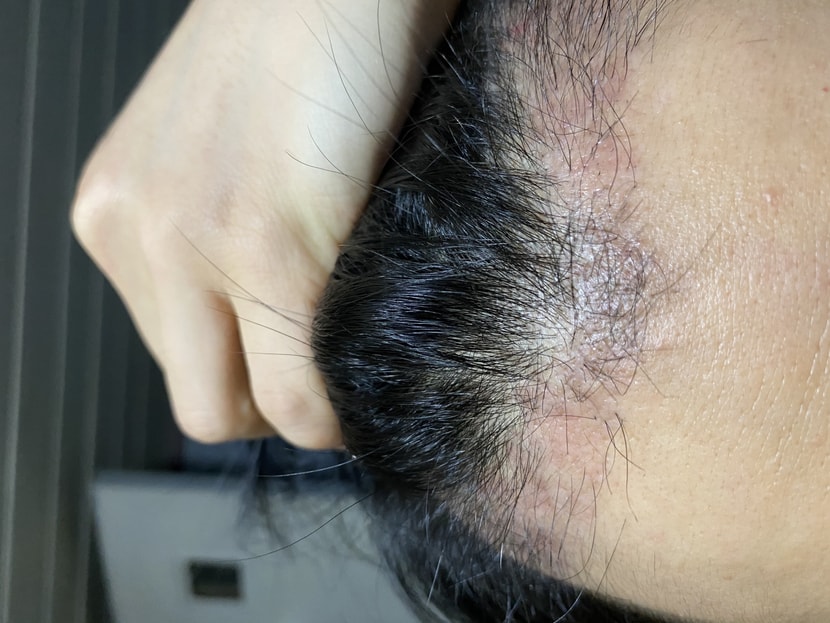 이 얇은털들이 굵어지기를 하루빨리 !!