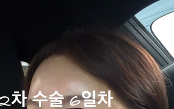 2025년 5월 2차 수술 6일차