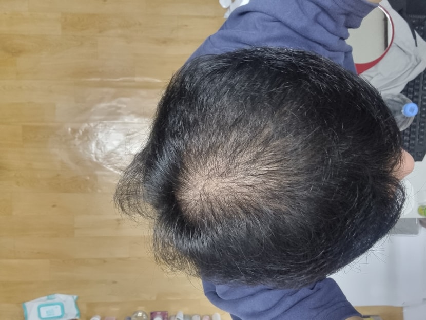 정수리