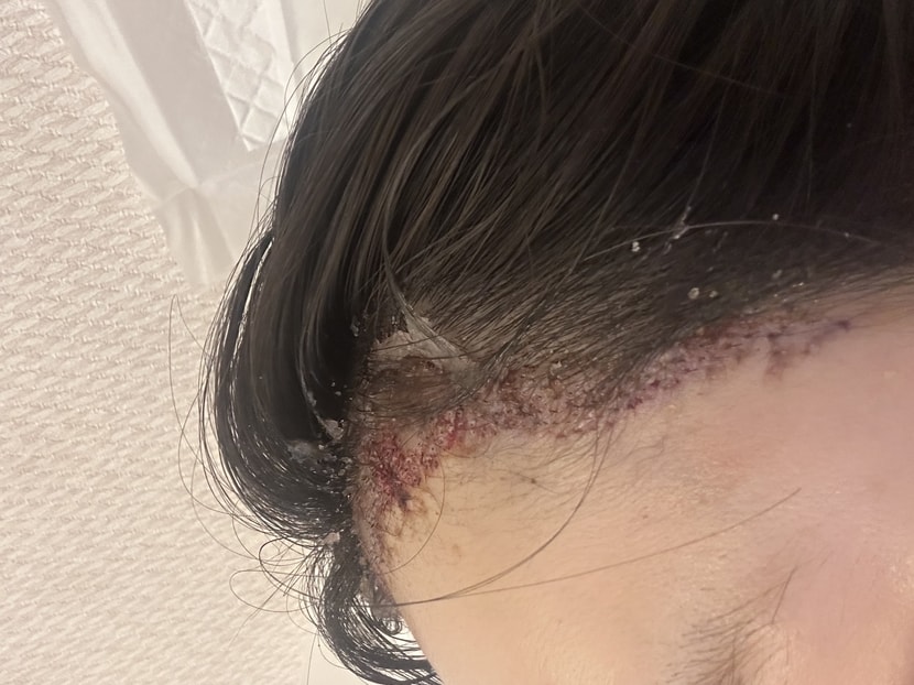 구레나룻 부분이 좀 지워진거 같은데 저거 저대로 나둬야 하나요?? 