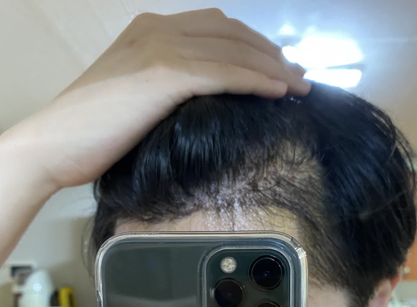 오른쪽