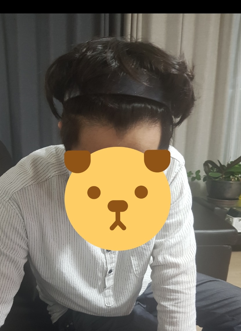 이식전