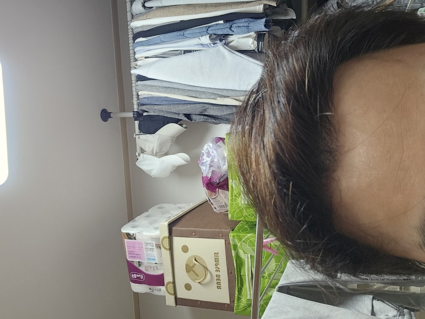 1년1개월 경과