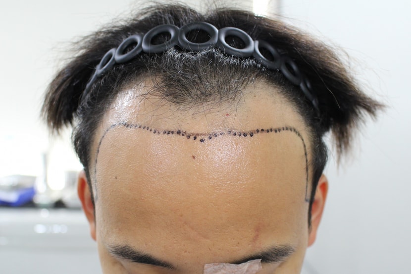 Before