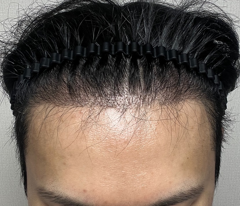 6개월  위