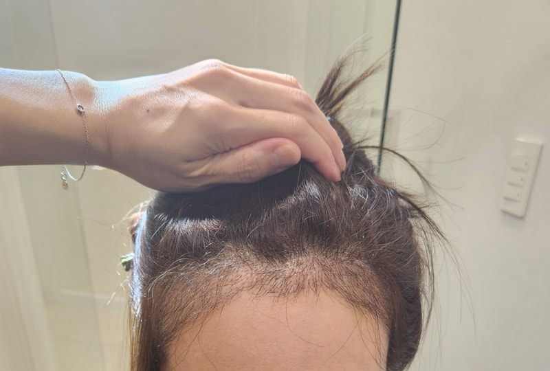 1年後記、評価要請