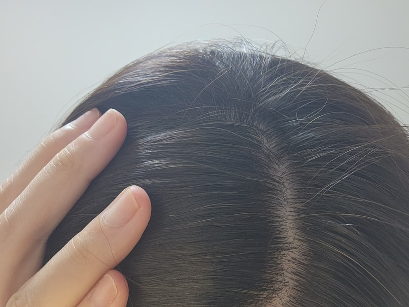 다른 곳 밀도 사진