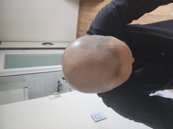 수술전 아침에 찍은사진