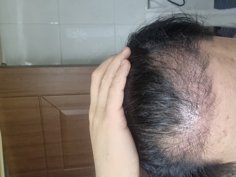 密度が潰れたようですね？？