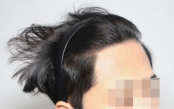 수술후 입니다!