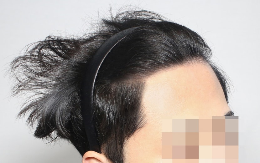 수술후 입니다!