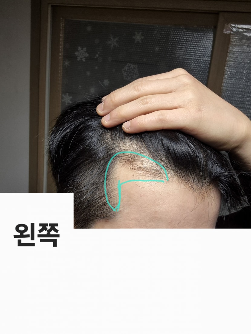 왼쪽