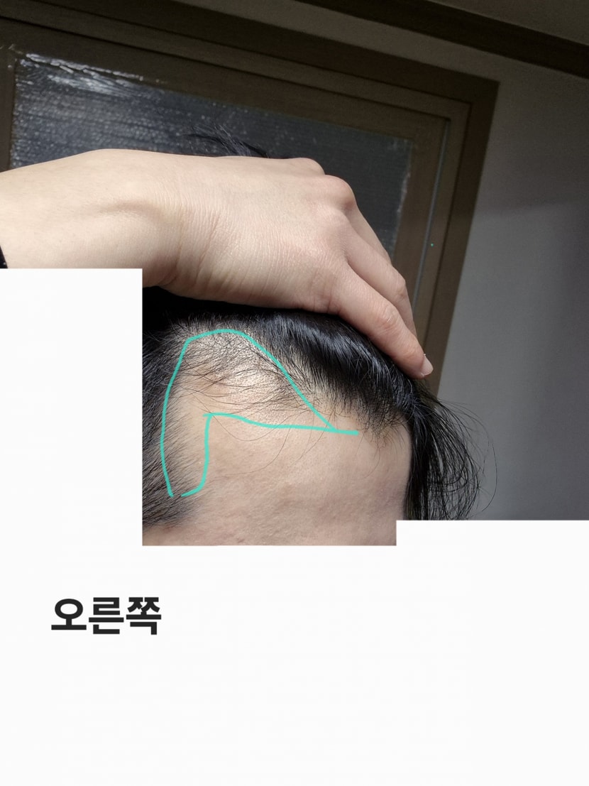 오른쪽