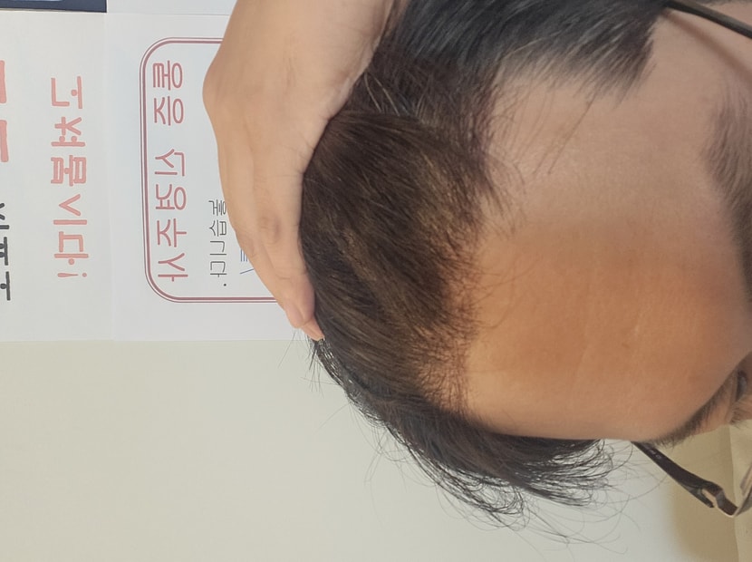 현재 11일차
