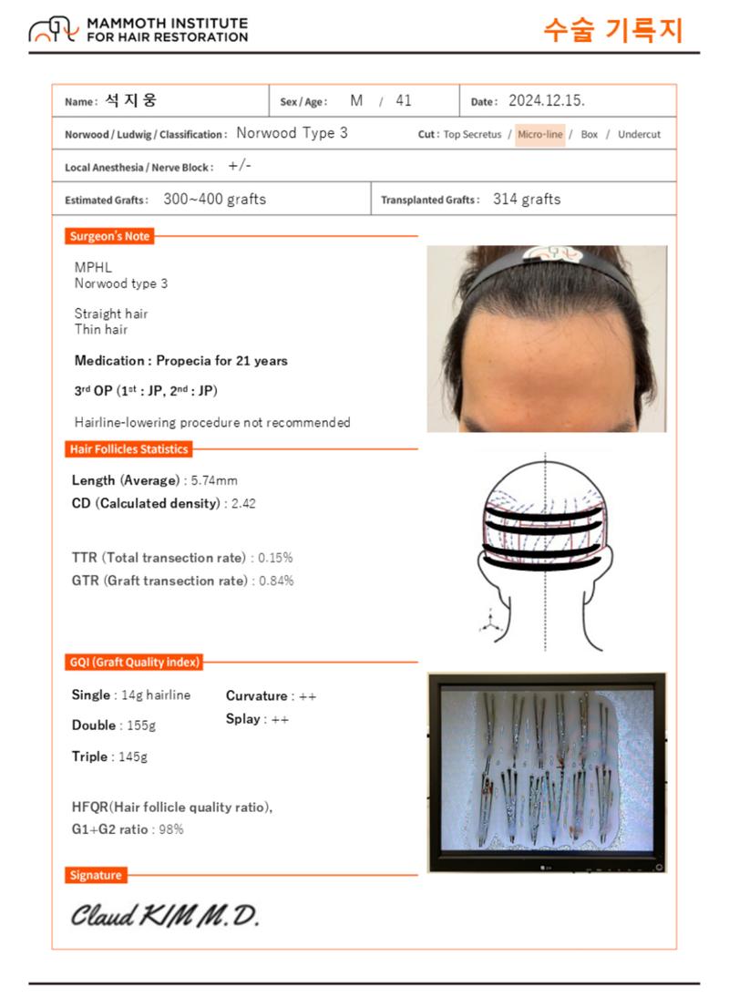 我是狎鸥亭Mammos Hairine医院的院长石志雄。 [对釜山Mammos毛发移植再手术的记录和考察]