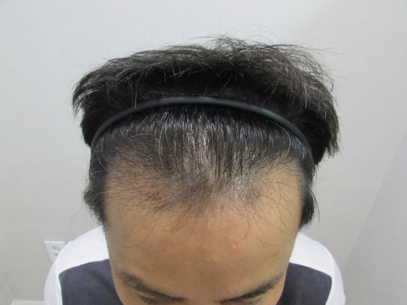 7개월 현재 모습 입니다 