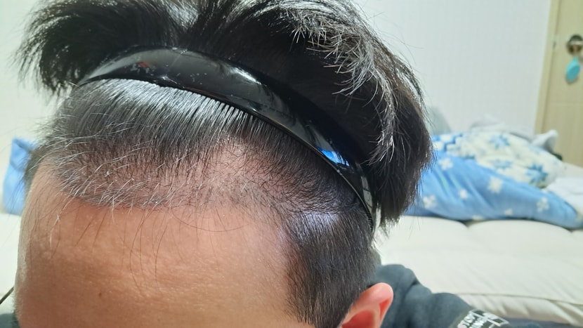왼쪽