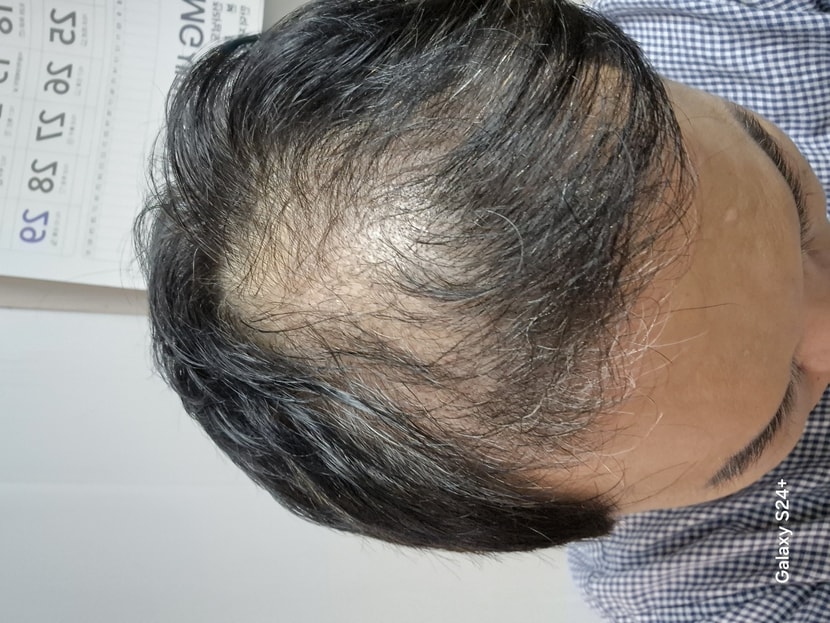 2달
