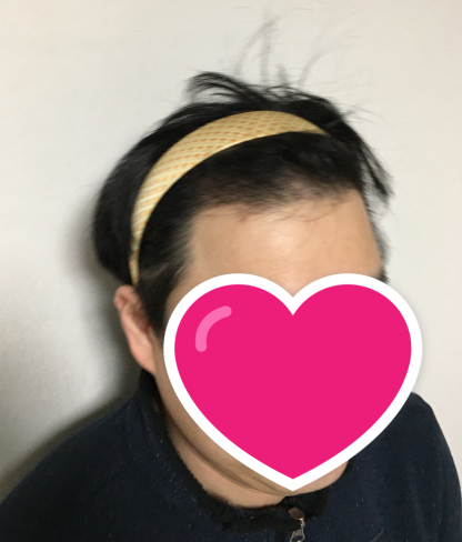 수술 후