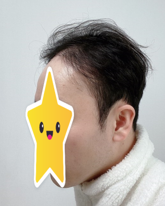 수술 전
