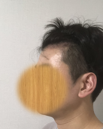 현재 입니다 (3개월)