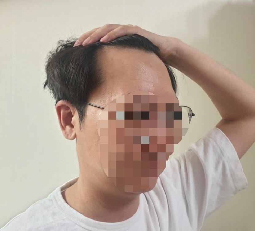 전