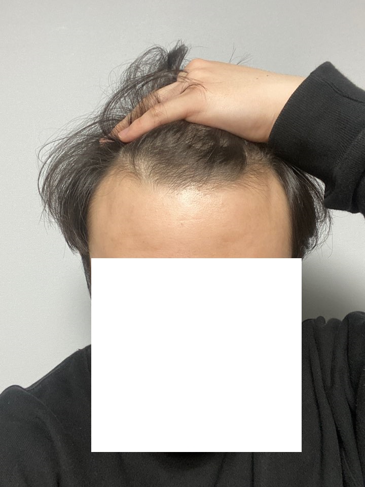 수술전