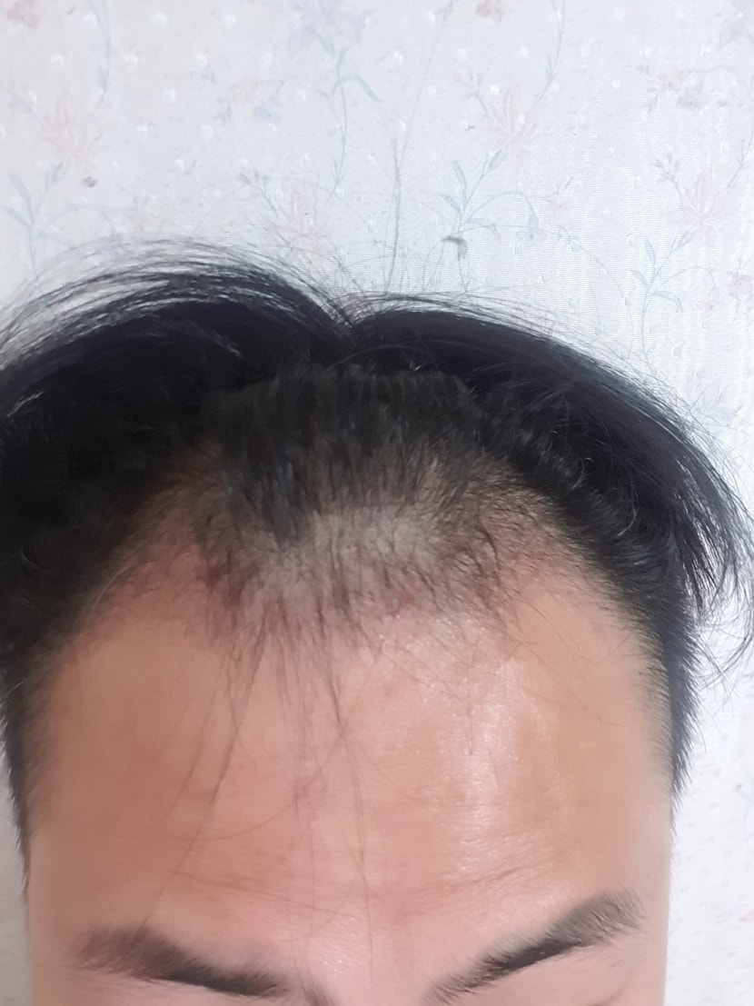3개월