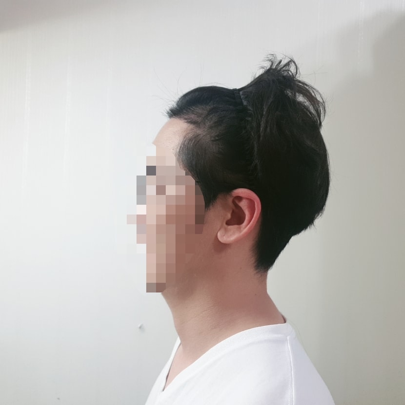후