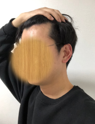 수술 전입니다