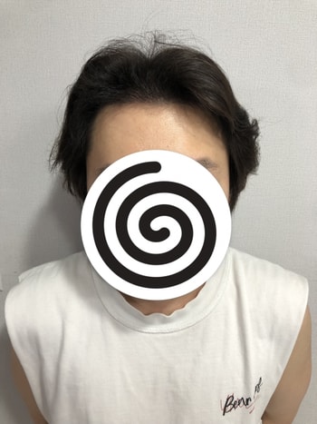수술후