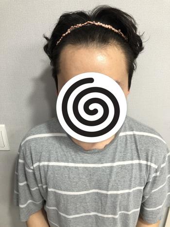 수술전