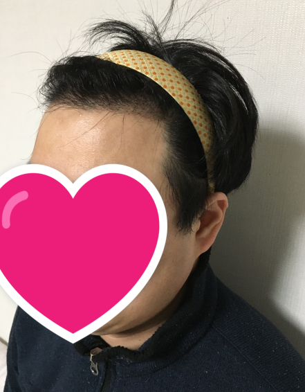 수술 후