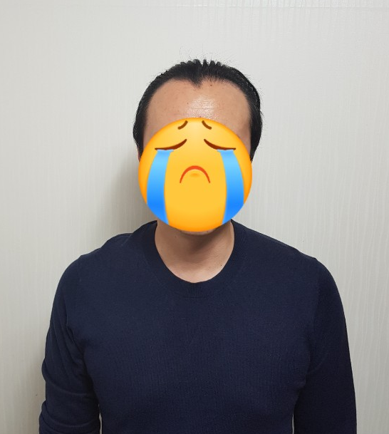 수술 전 입니다.