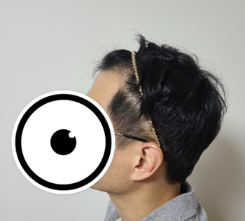 수술 전 사진들이에요