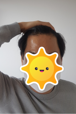 수술 전 앞머리
