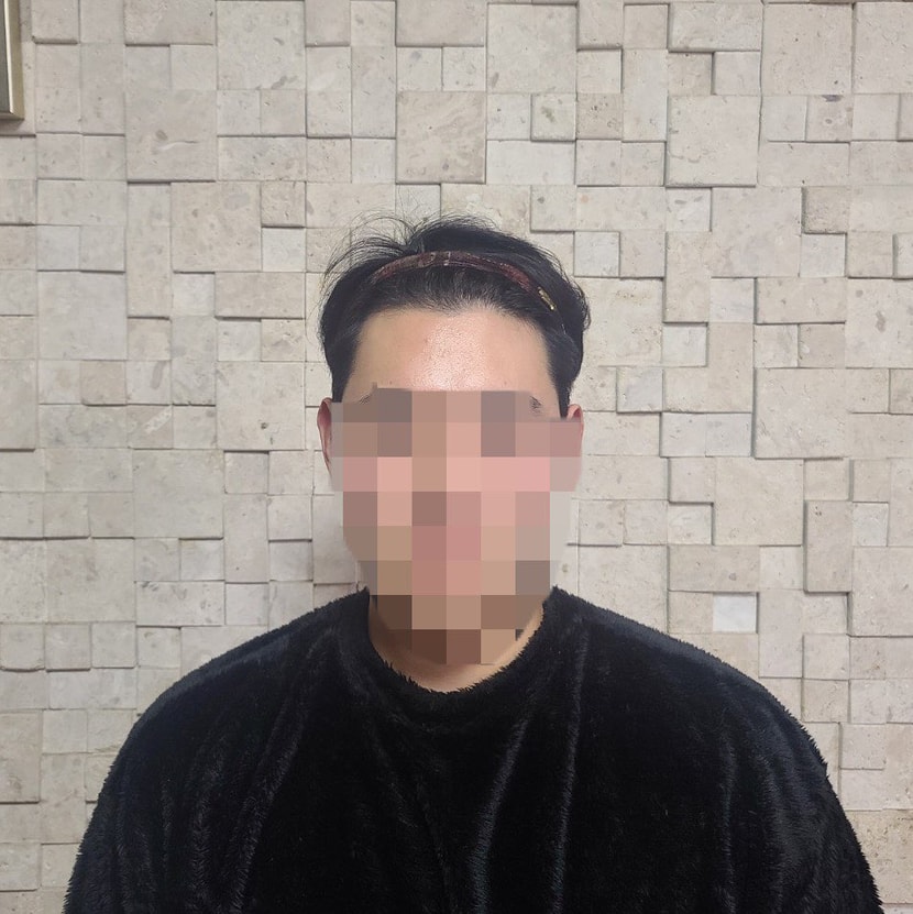 수술하기전