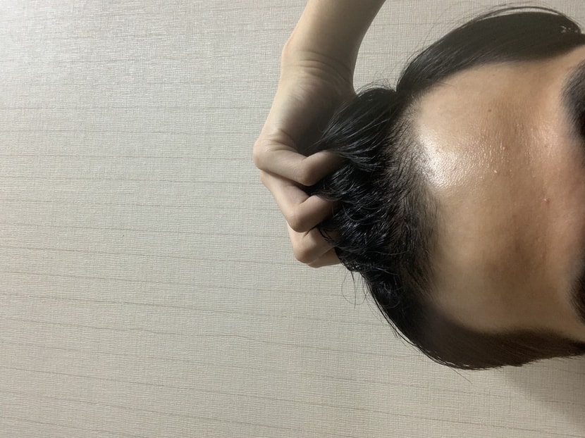 이식전