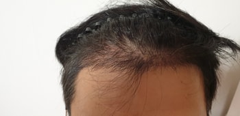 현재 사진들이에요