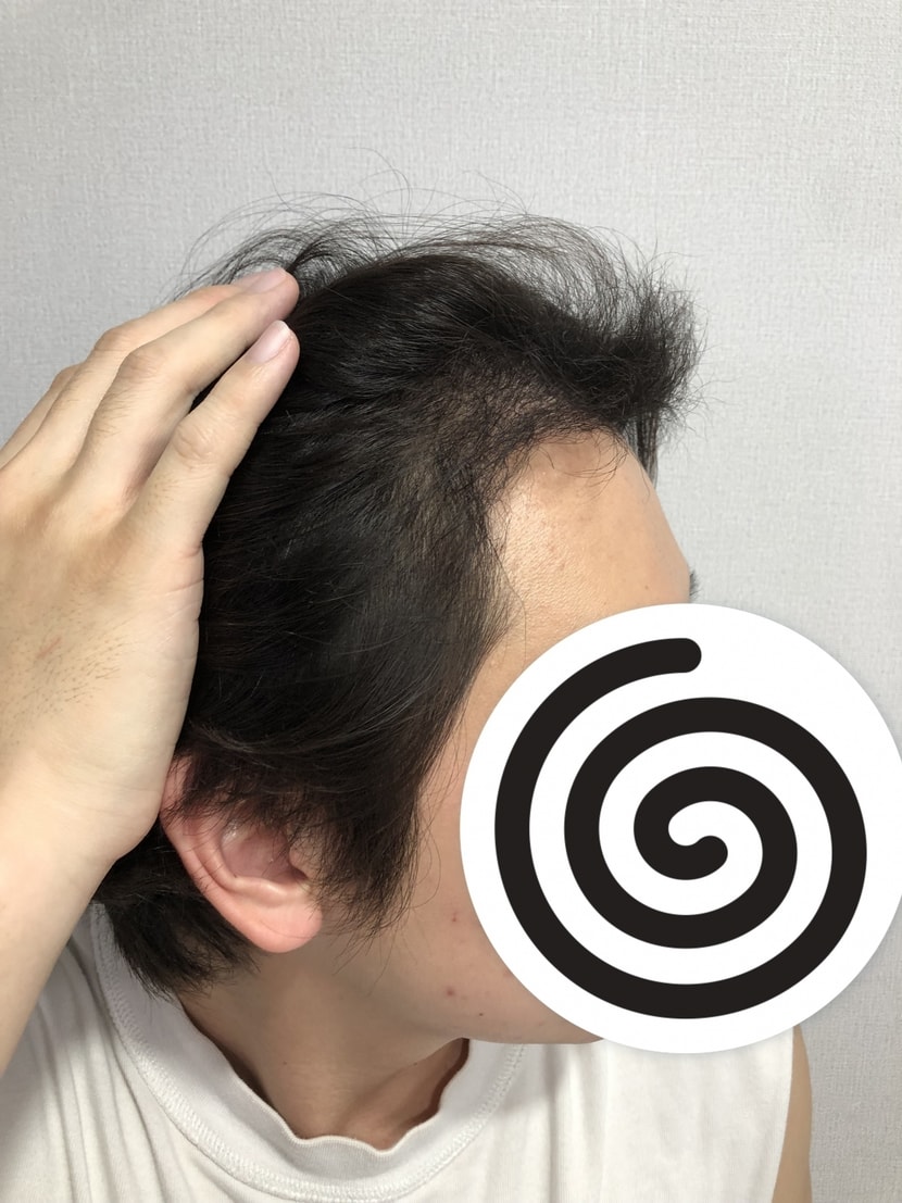 수술후